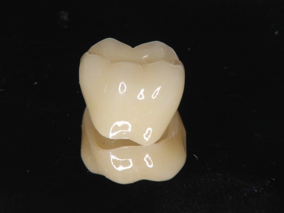 オールセラミックジルコニアクラウン 横浜桜木町歯科のブログ